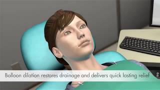 What is Balloon Sinuplasty?