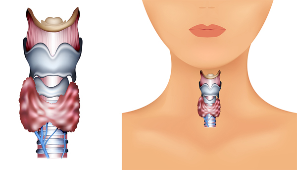 Thyroid Nodule