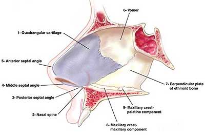 In a situation where a deviated nasal septum is determined to be a significant causative factor of nasal obstruction, surgical correction of the deviation may be recommended. 