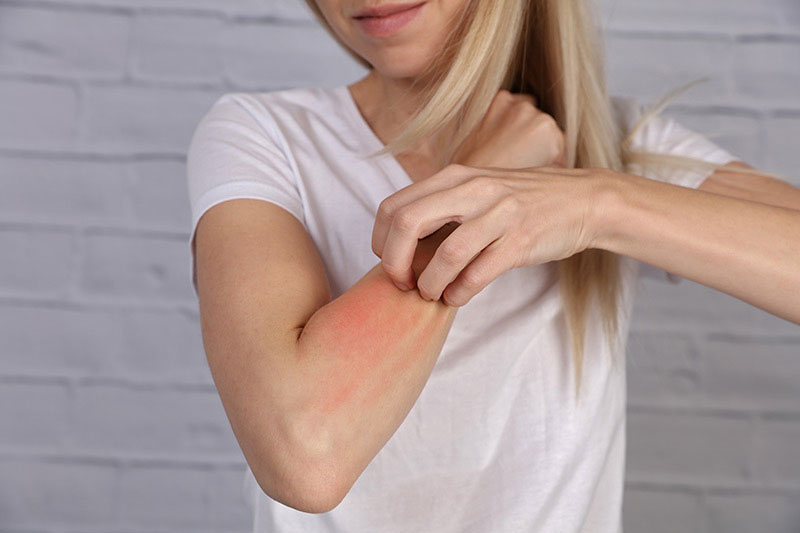 Skin allergies are very common and come in many different varieties.