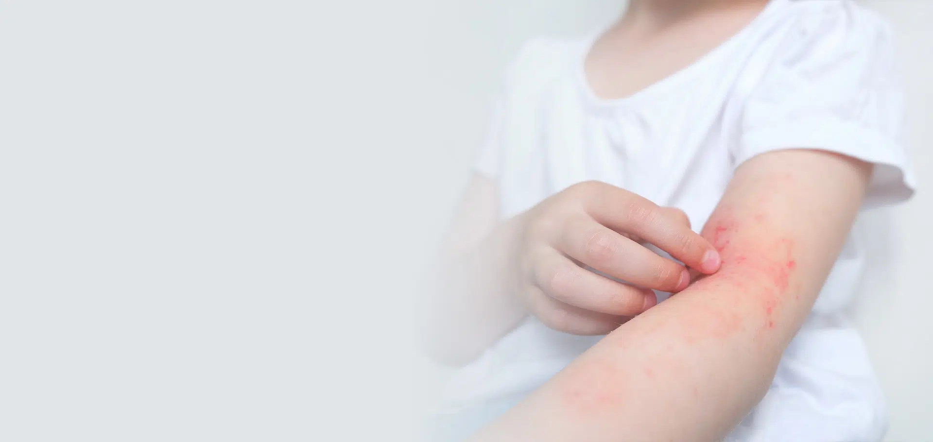 Allergic Contact Dermatitis in Philadelphia and New Jersey