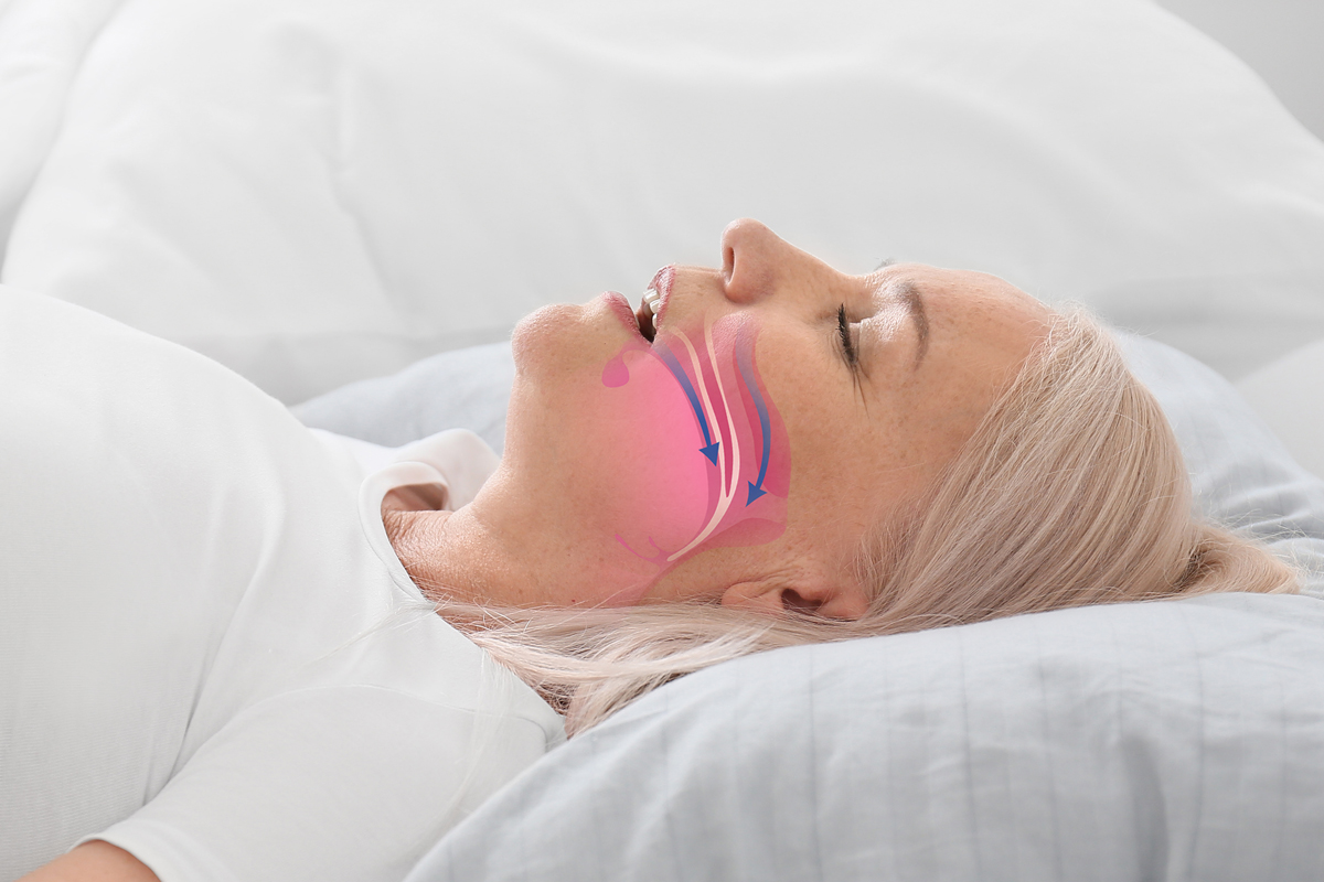 Best Nasal Strips for Snoring of 2024