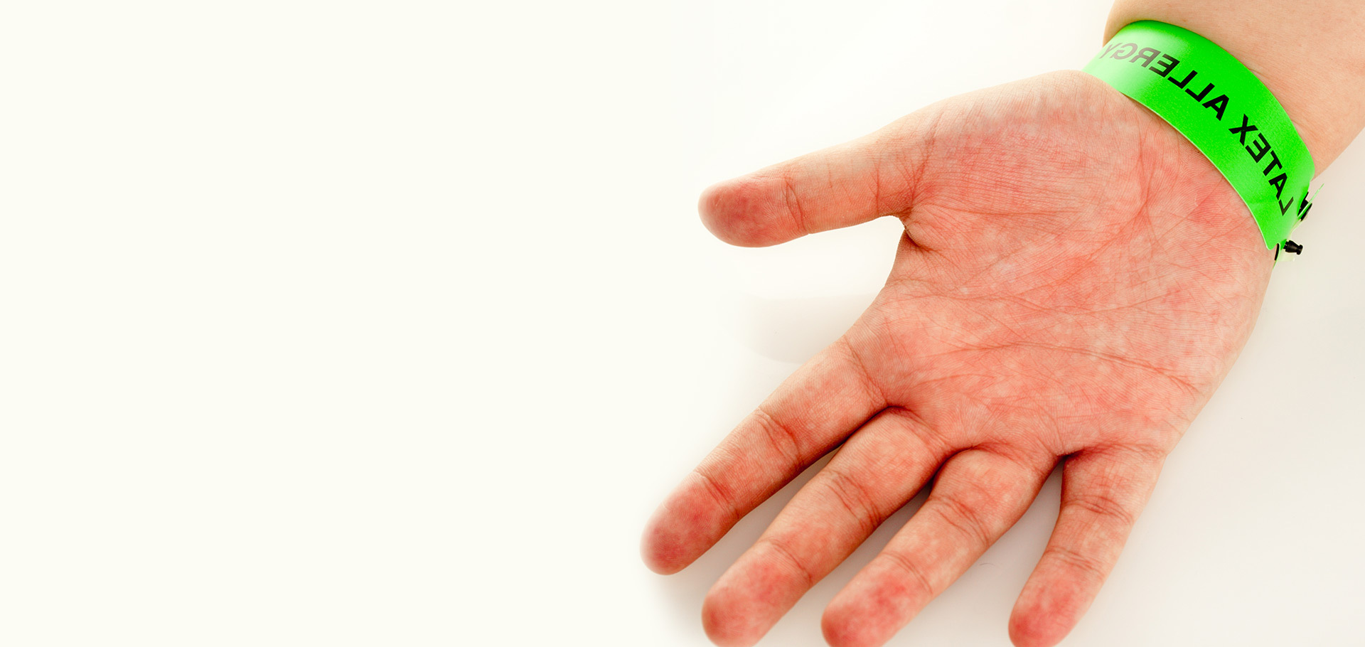 Latex Allergies Treatment in Philadelphia and New Jersey