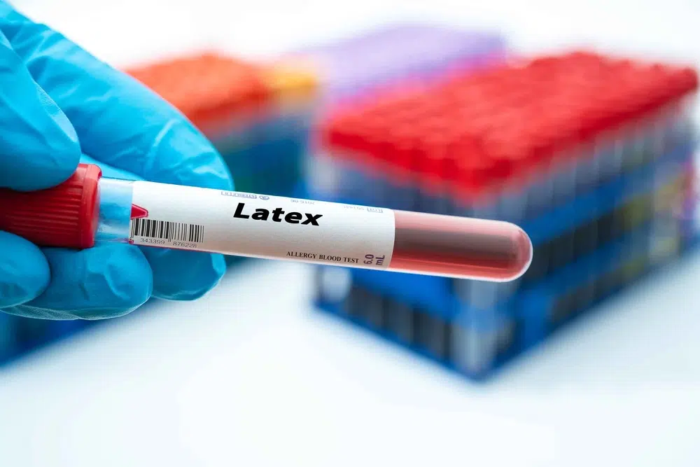 The Hidden Dangers of Latex: Understanding and Diagnosing Latex Allergies