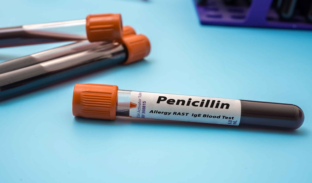 Penicillin Allergy Treatment: Finding the Best Doctors for Your Needs