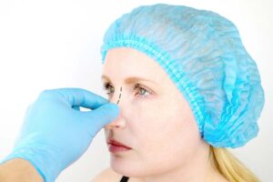 During a septoplasty, cartilage may be removed or adjusted, and splints or packing may be inserted into the nose to stabilize the structures and promote healing.