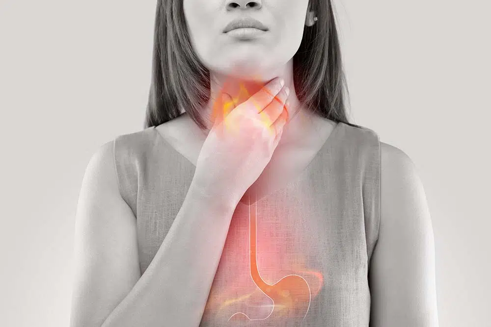 Acid reflux symptoms, also known as gastroesophageal reflux disease (GERD), can include heartburn, a sour taste in the mouth, regurgitation of stomach acid, and chest pain