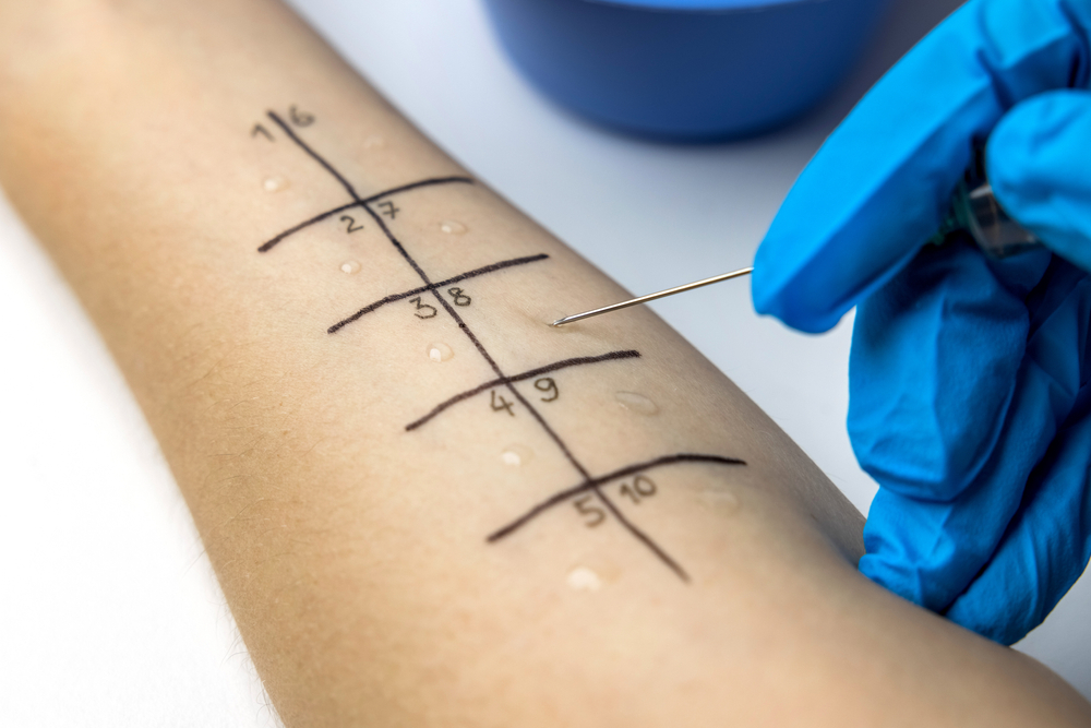Allergic Reactions Unveiled: Understanding the Telltale Signs of Food Allergy