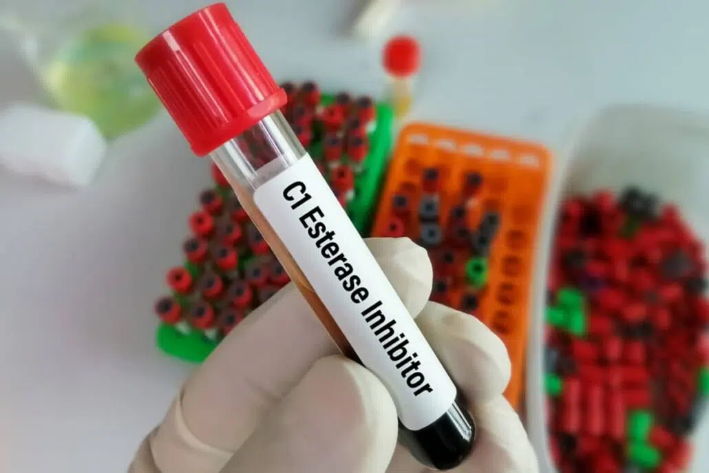 Low levels of C1 inhibitors can be caused by genetic mutations, making genetic testing an important part of the diagnosis and management of HAE.