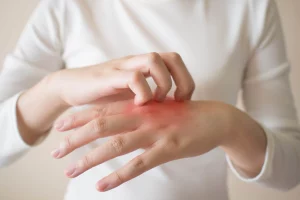 It is important to seek medical attention if you suspect a drug allergy rash, as it can lead to serious complications if not treated promptly.