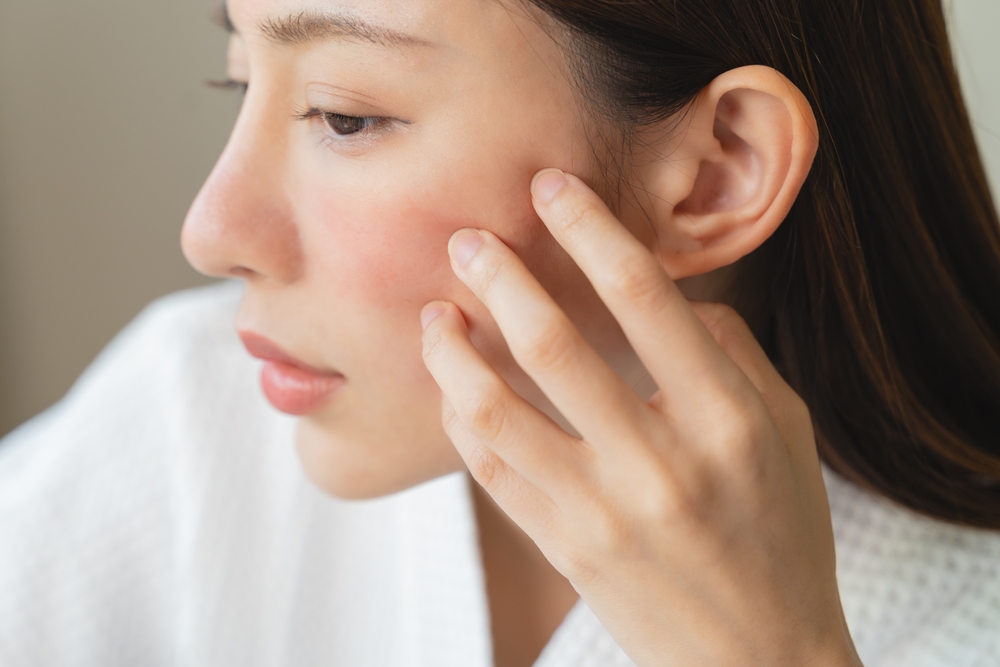 Woman with facial flushing touching her cheek, illustrating a symptom of alcohol intolerance due to ALDH2 deficiency.