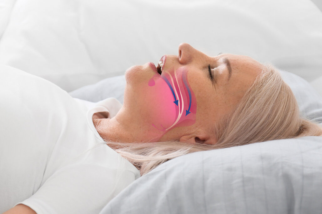 Elderly woman lying down with airway diagram showing obstruction, highlighting breathing difficulty and emergency risk.