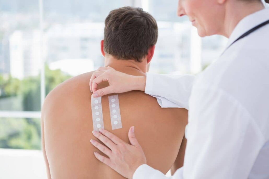 Doctor applying patch test strips to a patient’s back to identify contact allergens causing delayed skin reactions.