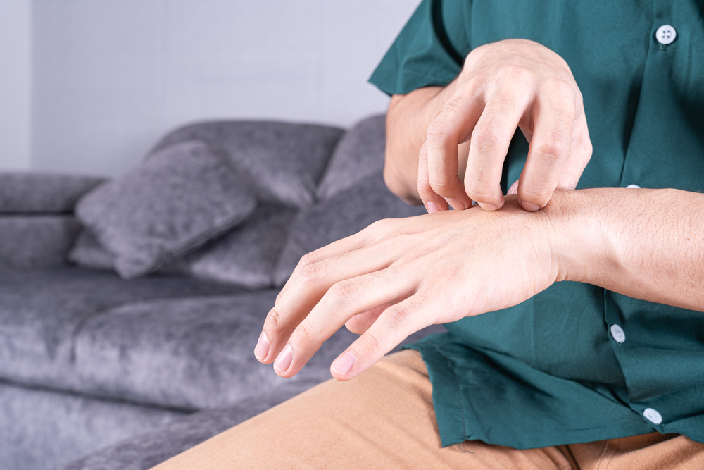 Man scratching his hand due to nickel allergy, showing symptoms of allergic contact dermatitis from metal exposure.