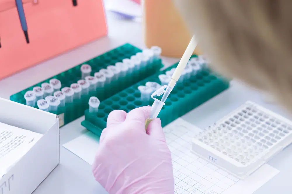 Lab technician handling allergy immunotherapy vials and testing tray for SCIT and SLIT treatment options.