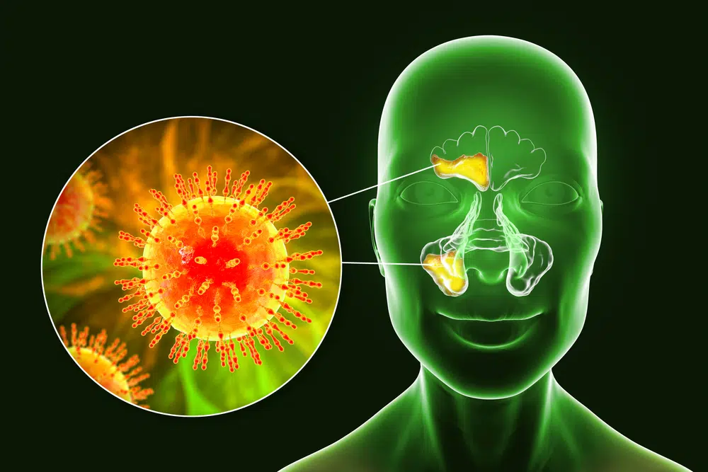 Illustration of sinus infection virus with highlighted nasal passages and prevention tips like handwashing and avoiding contact.