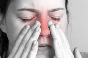 Person pressing nose and eye area showing sinus pain with redness indicating pressure and inflammation