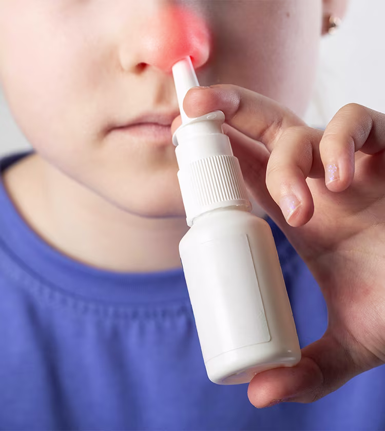 Child using nasal spray for adenoid hypertrophy treatment to relieve nasal congestion and breathing symptoms.