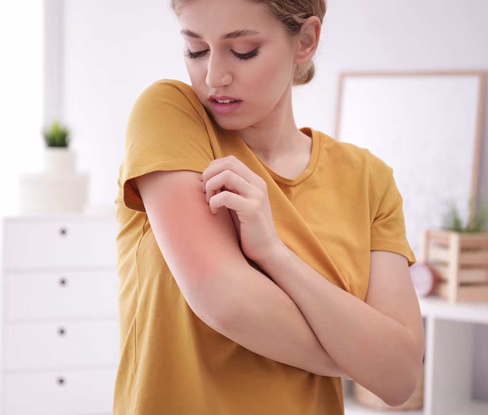 Say Goodbye to Skin Allergies: Treatments for Allergic Contact Dermatitis