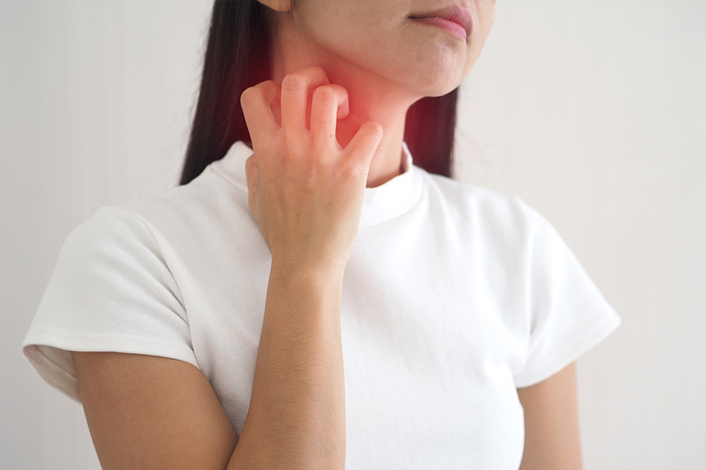 Woman scratching irritated neck caused by skin allergy, showing itching and allergic reaction symptoms.