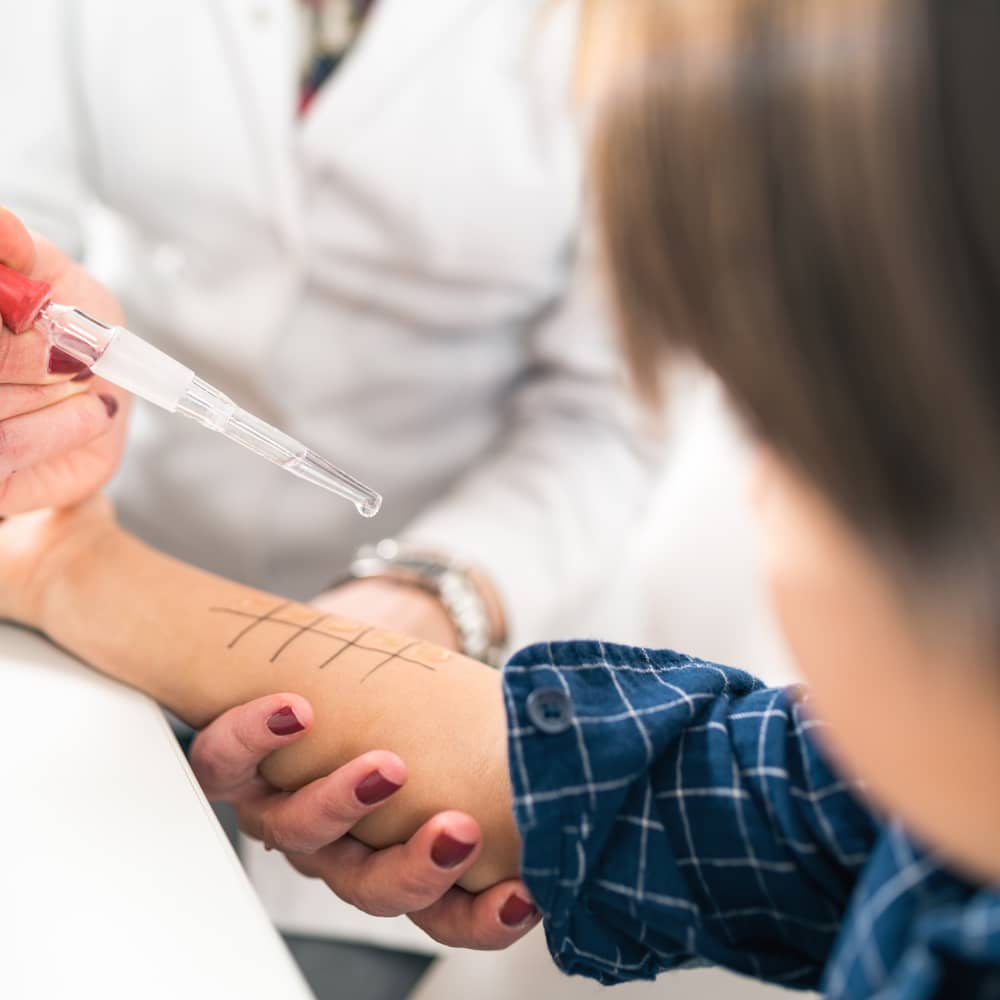 Doctor performing allergy skin test on patient's arm with numbered test sites and medical supplies on table.