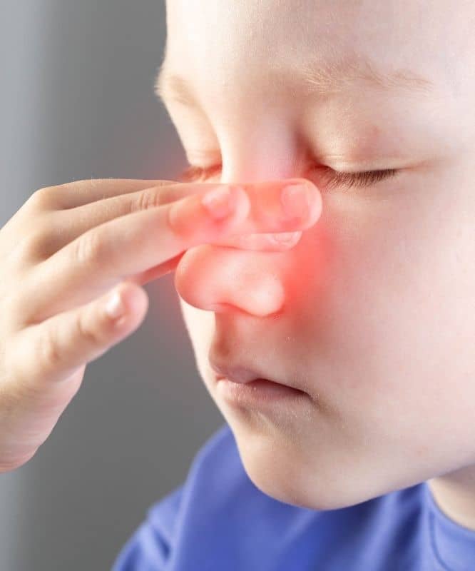 Pediatric sinus and allergy symptoms can include congestion, nasal drainage, headaches, fatigue, and postnasal drip.